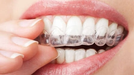 ✨自然な白い歯で爽やかな口元！✨KIHAKU/キハク システム | pybli.com.my